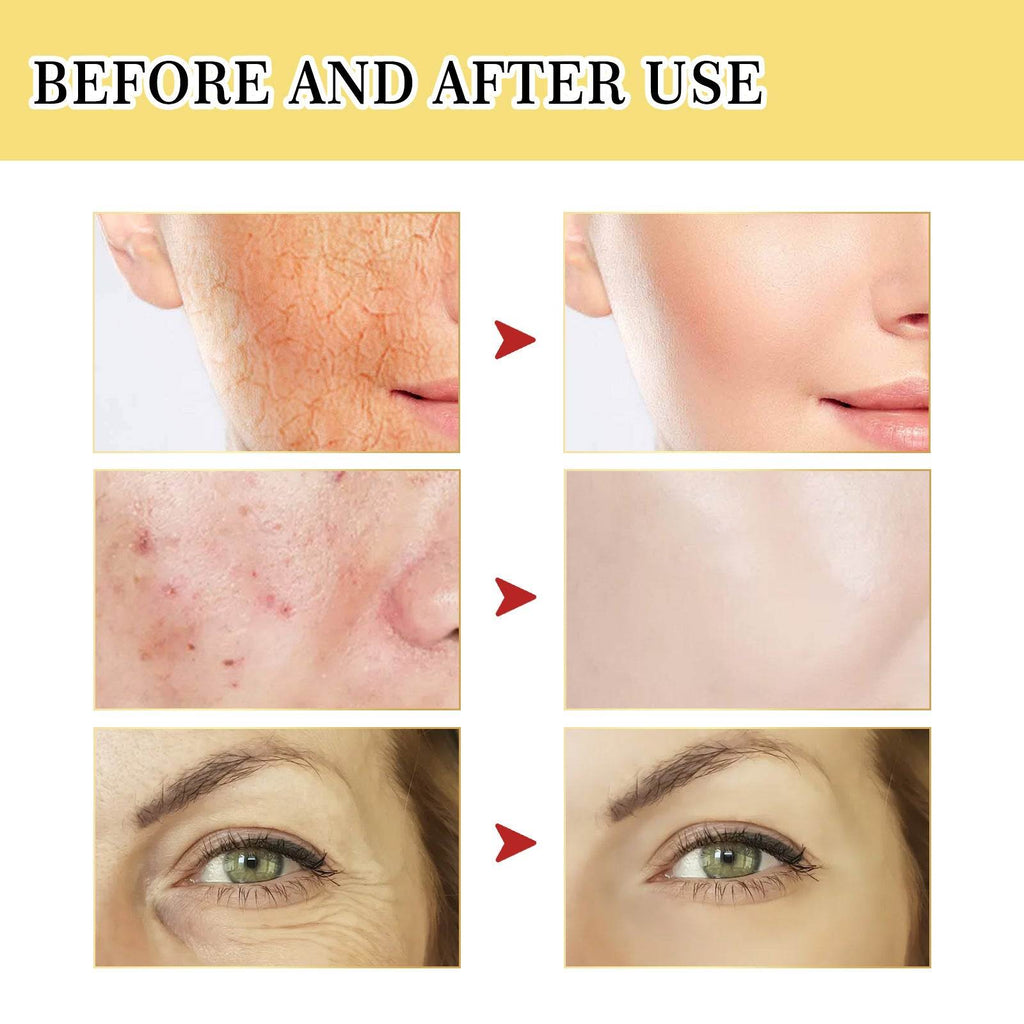 Snail Serum Collagen Facial Serum Original - Laylace