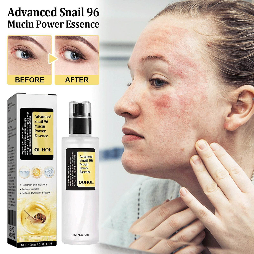 Snail Serum Collagen Facial Serum Original - Laylace